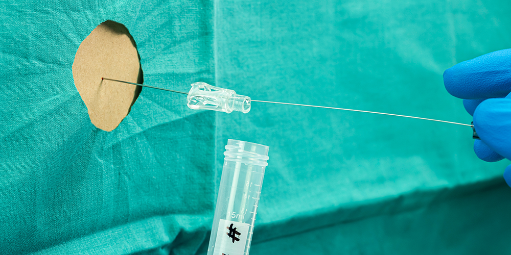 Warsztaty z nakłucia lędźwiowego