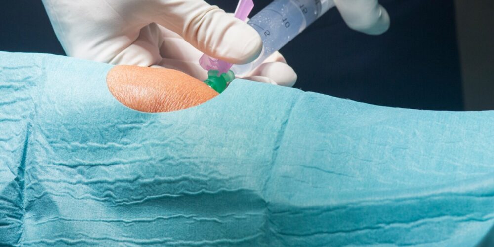 Warsztaty kapilaroskopii