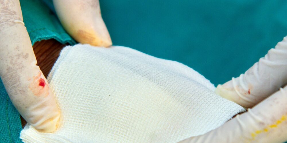 metody tamowania krwotoków