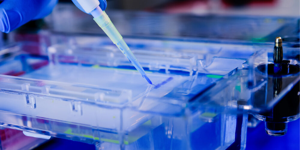 Elektroforeza od podstaw- czyli jak rodzielić DNA